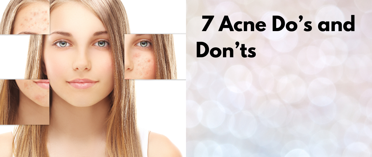 7 Acne Dos and Donts
