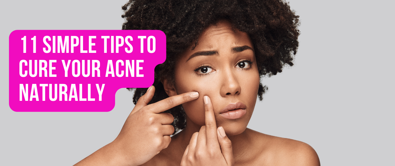 11 Simple Tips To Cure Your Acne Naturally