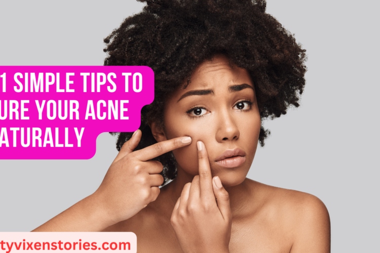 11 Simple Tips To Cure Your Acne Naturally