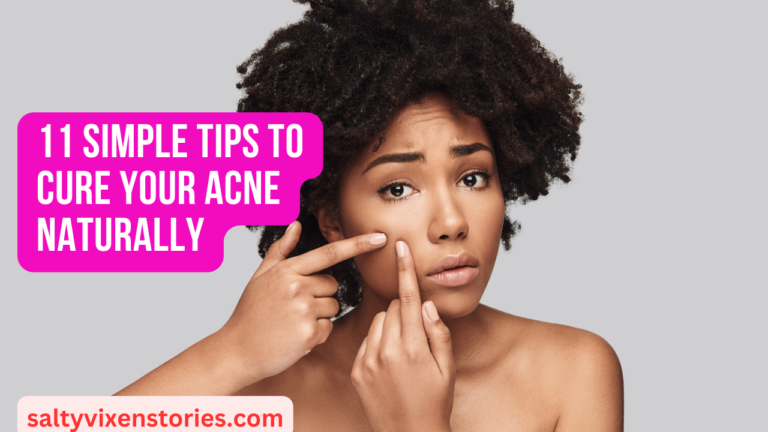 11 Simple Tips To Cure Your Acne Naturally