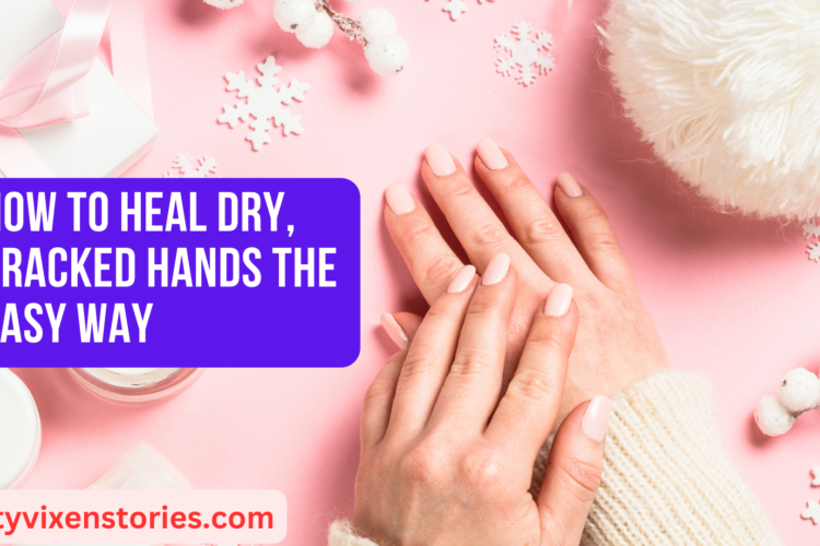 How to Heal Dry Cracked Hands the Easy Way